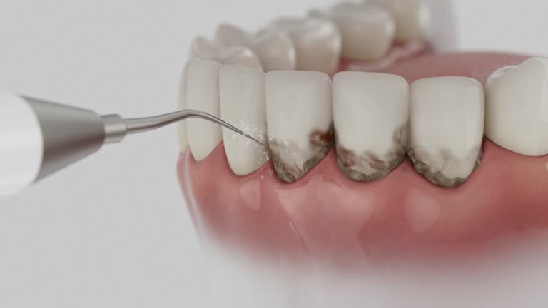 Trusted Root Canal Treatment service in Vandalia, MO - Dentist Open Now
